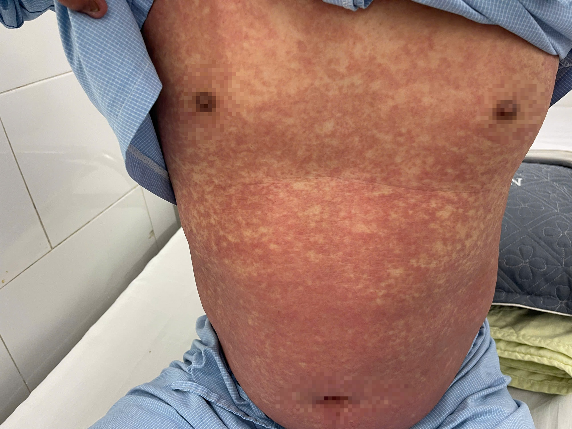 Cảnh báo thuốc đã bị cấm tại Việt Nam nhưng vẫn được rao bán trên mạng- Ảnh 1. Cảnh báo thuốc đã bị cấm tại Việt Nam nhưng vẫn được rao bán trên mạng- Ảnh 1.